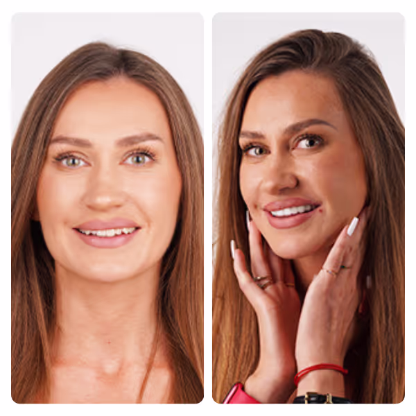 Hollywood Smile in Turkey